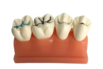Модель обучения стоматологии полости рта общение стоматолога с врачом и пациентом модель зуба с закрытыми 3-кратными ямками и канавками